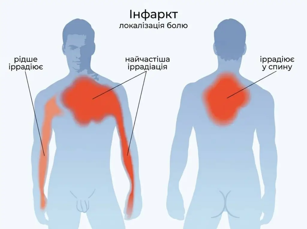 де болить серце фото